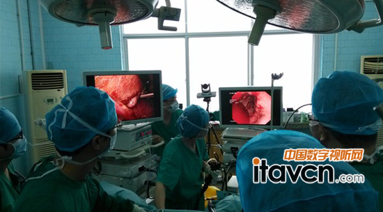 圖-采用雙內(nèi)窺鏡進(jìn)行直腸癌腫瘤切除