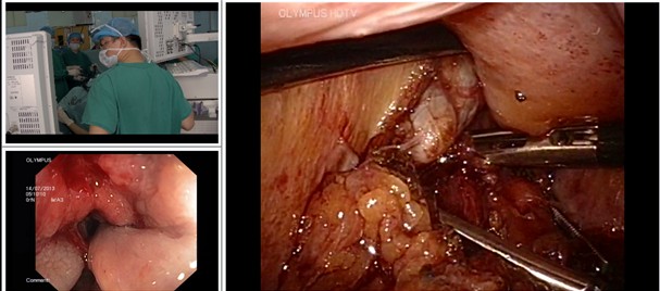 圖-遠(yuǎn)程觀摩效果